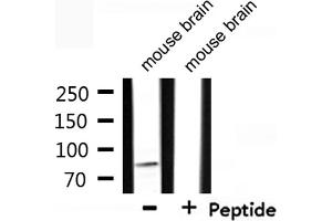 Western blot analysis of extracts from mouse brain, using CDH15 Antibody. (CDH15 antibody  (N-Term))