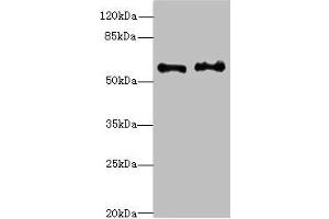 Western blot All lanes: NMT2 antibody at 4. (NMT2 antibody  (AA 1-120))