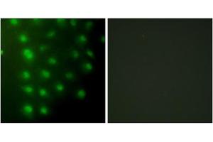 Immunofluorescence analysis of HUVEC cells, using AKAP8 antibody. (AKAP8 antibody  (Internal Region))