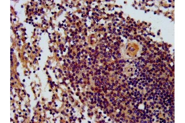 THO Complex 5 antibody  (AA 2-53)