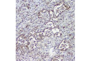 IHC analysis of MPI using anti-MPI antibody (ABIN4886672). (MPI antibody  (AA 2-99))