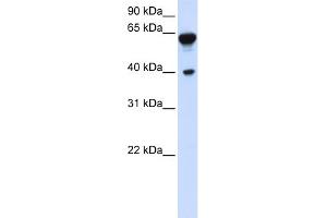 WB Suggested Anti-DTNB Antibody Titration:  0. (Dystrobrevin beta antibody  (C-Term))