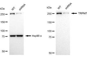 Western blotting analysis using TRPM7 antibody (ABIN7800608).