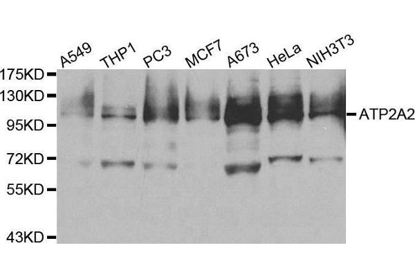 ATP2A2 antibody  (AA 111-253)