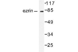 Image no. 2 for anti-Ezrin (EZR) antibody (ABIN265410) (Ezrin antibody)