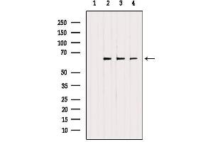 Western blot analysis of extracts from various samples, using ETFDH Antibody. (ETFDH antibody  (C-Term))