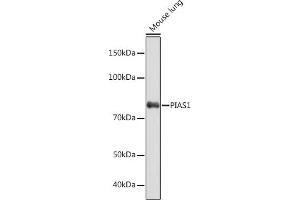Western blot analysis of extracts of Mouse lung, using PI Rabbit mAb (ABIN7269622) at 1:1000 dilution. (PIAS1 antibody)
