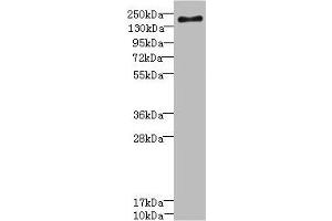 Western blot All lanes: SCN7A antibody at 2. (SCN7A antibody  (AA 265-368))
