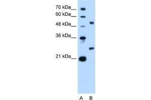 Western Blotting (WB) image for anti-BCL2-Like 1 (BCL2L1) antibody (ABIN2460189) (BCL2L1 antibody)