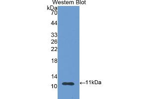Detection of Recombinant S100A6, Rat using Polyclonal Antibody to S100 Calcium Binding Protein A6 (S100A6) (S100A6 antibody  (AA 1-89))