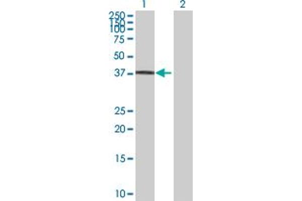 RNF34 Antikörper  (AA 1-373)