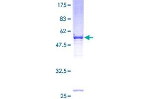 Image no. 1 for Voltage-Dependent Anion Channel 2 (VDAC2) (AA 1-283) protein (GST tag) (ABIN1324967) (VDAC2 Protein (AA 1-283) (GST tag))