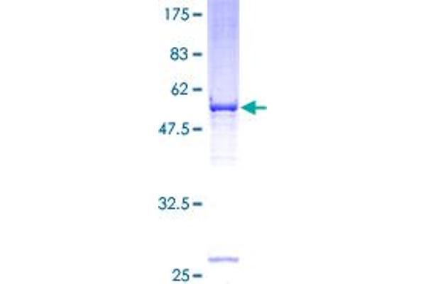 VDAC2 Protein (AA 1-283) (GST tag)