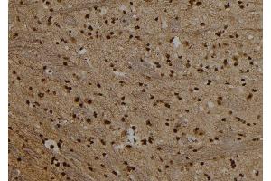 ABIN6279684 at 1/100 staining Rat brain tissue by IHC-P. (PRDM10 antibody  (C-Term))