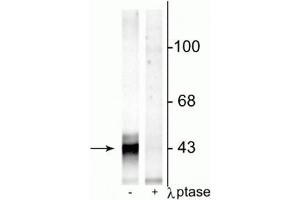 Western blot of rat hippocampal lysate showing specific immunolabeling of the ~43 kDa connexin43 phosphorylated at Ser368 in the first lane (-). (Connexin 43/GJA1 antibody  (pSer368))