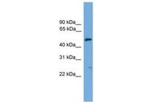 Image no. 1 for anti-Exocyst Complex Component 4 (EXOC4) (AA 71-120) antibody (ABIN6745615) (Sec8 antibody  (AA 71-120))