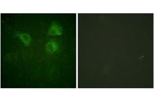 Immunofluorescence (IF) image for anti-Cell Division Cycle 25 Homolog B (S. Pombe) (CDC25B) (AA 289-338) antibody (ABIN1532237)