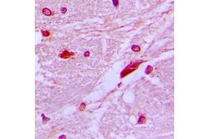 Immunohistochemical analysis of CUX1 staining in human brain formalin fixed paraffin embedded tissue section. (CUX1 antibody  (N-Term))