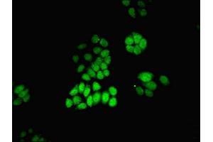 Immunofluorescent analysis of PC-3 cells using ABIN7168530 at dilution of 1:100 and Alexa Fluor 488-congugated AffiniPure Goat Anti-Rabbit IgG(H+L) (MAT2A antibody  (AA 1-395))