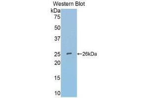 Western Blotting (WB) image for anti-Secreted Frizzled-Related Protein 4 (SFRP4) (AA 25-222) antibody (ABIN3203489) (SFRP4 antibody  (AA 25-222))
