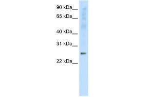 Western Blot showing SNAP25 antibody used at a concentration of 1-2 ug/ml to detect its target protein. (SNAP25 antibody  (C-Term))