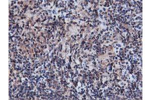 Image no. 8 for anti-V-Akt Murine Thymoma Viral Oncogene Homolog 1 (AKT1) antibody (ABIN1496557) (AKT1 antibody)