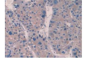 IHC-P analysis of Human Liver Tissue, with DAB staining. (IL10RB antibody  (AA 87-243))