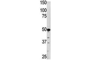 Western blot analysis of PGK2 in HepG2 lysate. (PGK2 antibody  (AA 117-145))