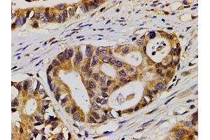 Immunohistochemistry (IHC) image for anti-Ephrin B2 (EFNB2) (C-Term) antibody (ABIN6261455)