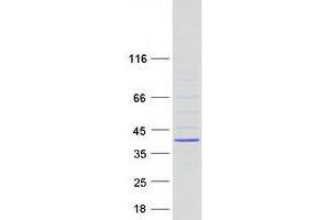 Zinc Finger, C2HC-Type Containing 1C (ZC2HC1C) (Transcript Variant 2) protein (Myc-DYKDDDDK Tag)