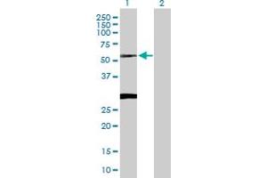 Western Blot analysis of CLN3 expression in transfected 293T cell line by CLN3 MaxPab polyclonal antibody. (CLN3 antibody  (AA 1-438))