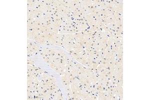 Immunohistochemistry of paraffin embedded rat heart using HDAC (ABIN7074234) at dilution of 1:1200 (300x lens) (HDAC11 antibody)