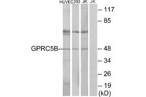 Western blot analysis of extracts from HUVEC cells, 293cells and Jurkat cells, using GPRC5B antibody. (GPRC5B antibody  (Internal Region))