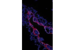 Image no. 1 for anti-Transforming Growth Factor, beta Receptor III (TGFBR3) (Extracellular Domain) antibody (ABIN265019) (TGFBR3 antibody  (Extracellular Domain))