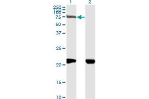 Western Blot analysis of NRP1 expression in transfected 293T cell line by NRP1 monoclonal antibody (M05), clone 1B3.