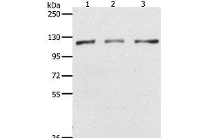 Western Blot analysis of Hela, K562 and Jurkat cell using PARP1 Polyclonal Antibody at dilution of 1:350 (PARP1 antibody)