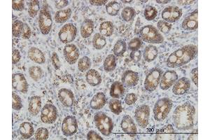 Immunoperoxidase of monoclonal antibody to IDH2 on formalin-fixed paraffin-embedded human colon. (IDH2 antibody  (AA 354-451))