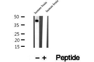 Western blot analysis of extracts of human brain tissue, using TMOD1 antibody. (Tropomodulin 1 antibody  (N-Term))