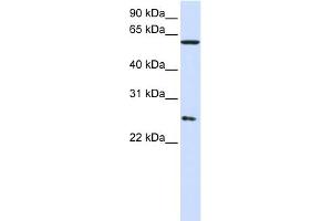 WB Suggested Anti-CCT7 Antibody Titration: 0. (CCT7 antibody  (Middle Region))