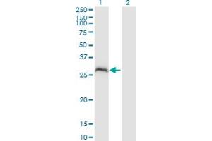 Western Blot analysis of PPP1R2P3 expression in transfected 293T cell line by PPP1R2P3 monoclonal antibody (M02), clone 1H2. (PPP1R2P3 antibody  (AA 1-205))