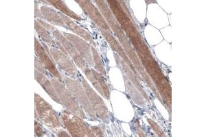 Immunohistochemical staining (Formalin-fixed paraffin-embedded sections) of human skeletal muscle with PGM1 monoclonal antibody, clone CL3299  shows moderate cytoplasmic immunoreactivity in muscle fibers.