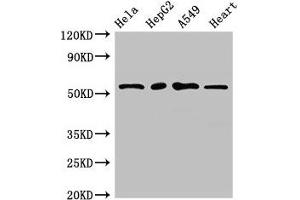 Western Blot Positive WB detected in: Hela whole cell lysate, HepG2 whole cell lysate, A549 whole cell lysate, Mouse heart tissue All lanes: MEF2D antibody at 2. (MEF2D antibody  (AA 299-509))