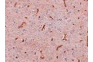 Immunohistochemistry of TWA1 in rat brain tissue with this product at 2. (GID8/C20orf11 antibody  (C-Term))