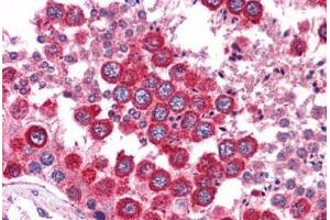 Human Testis: Formalin-Fixed, Paraffin-Embedded (FFPE) (WNT2B antibody  (N-Term))