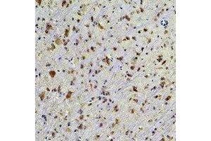 Immunohistochemical analysis of HSP90 beta staining in rat brain  formalin fixed paraffin embedded tissue section. (HSP90AB1 antibody)