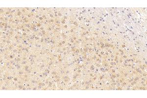 Detection of COX2 in Rat Cerebrum Tissue using Polyclonal Antibody to Cytochrome C Oxidase Subunit II (COX2) (COX2 antibody  (AA 83-227))