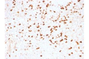 Formalin-fixed, paraffin-embedded human Tonsil stained with Lambda Light Chain Monoclonal Antibody (N10/2). (IgL antibody)