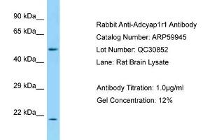 Western Blotting (WB) image for anti-Adenylate Cyclase Activating Polypeptide 1 (Pituitary) Receptor Type I (ADCYAP1R1) (C-Term) antibody (ABIN970063) (ADCYAP1R1 antibody  (C-Term))