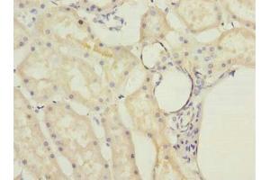 Immunohistochemistry of paraffin-embedded human kidney tissue using ABIN7142381 at dilution of 1:100 (MRPL22 antibody  (AA 41-206))
