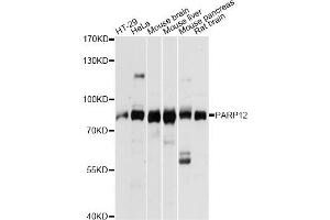 Western blot analysis of extracts of various cell lines, using PARP12 antibody. (PARP12 antibody)